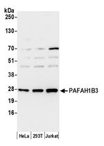 PAFAH1B3 Polyclonal Antibody