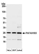 PAFAH1B3 Polyclonal Antibody