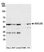SUCLG2 Polyclonal Antibody