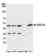 SUCLG2 Polyclonal Antibody