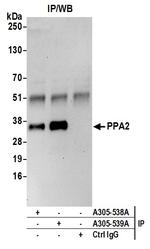 PPA2 Antibody in Immunoprecipitation (IP)
