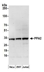 PPA2 Polyclonal Antibody
