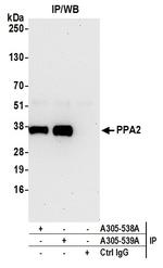 PPA2 Antibody in Immunoprecipitation (IP)