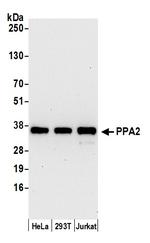PPA2 Polyclonal Antibody