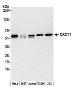 OXCT1 Polyclonal Antibody