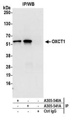 OXCT1 Antibody in Immunoprecipitation (IP)