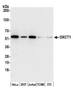 OXCT1 Polyclonal Antibody