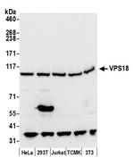 VPS18 Polyclonal Antibody