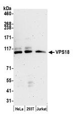 VPS18 Polyclonal Antibody