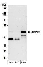 AMPD3 Polyclonal Antibody