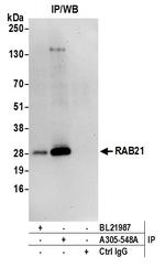 RAB21 Antibody in Immunoprecipitation (IP)