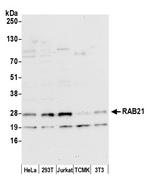 RAB21 Polyclonal Antibody