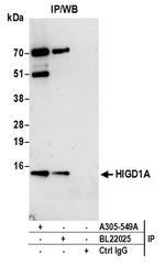 HIGD1A Antibody in Immunoprecipitation (IP)