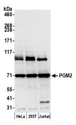 PGM2 Polyclonal Antibody