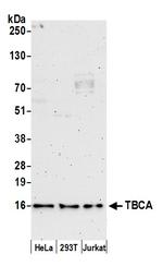 TBCA Polyclonal Antibody