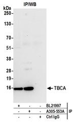 TBCA Antibody in Immunoprecipitation (IP)