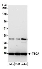 TBCA Polyclonal Antibody