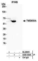TMEM30A Antibody in Immunoprecipitation (IP)