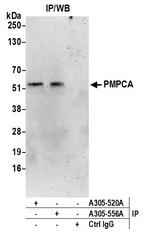 PMPCA Polyclonal Antibody