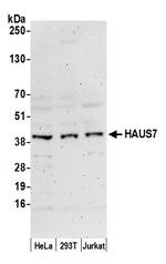 HAUS7 Polyclonal Antibody