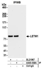 LETM1 Antibody in Immunoprecipitation (IP)