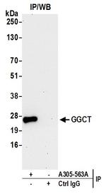 GGCT Antibody in Immunoprecipitation (IP)