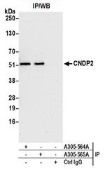 CNDP2 Polyclonal Antibody