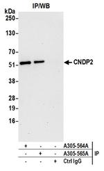CNDP2 Antibody in Immunoprecipitation (IP)