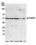 CNDP2 Polyclonal Antibody