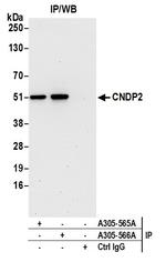 CNDP2 Antibody in Immunoprecipitation (IP)