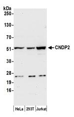 CNDP2 Polyclonal Antibody