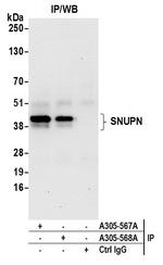SNUPN Antibody in Immunoprecipitation (IP)