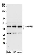 SNUPN Polyclonal Antibody