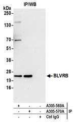 BLVRB/Biliverdin reductase B Antibody in Immunoprecipitation (IP)