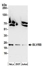 BLVRB/Biliverdin reductase B Polyclonal Antibody
