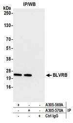 BLVRB/Biliverdin reductase B Antibody in Immunoprecipitation (IP)