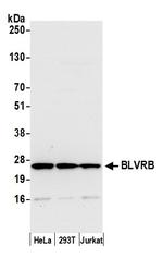 BLVRB/Biliverdin reductase B Polyclonal Antibody