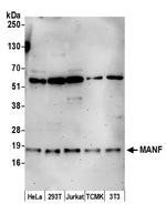 MANF Polyclonal Antibody
