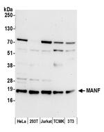 MANF Polyclonal Antibody