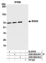 RIOK3 Antibody in Immunoprecipitation (IP)