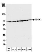 RIOK3 Polyclonal Antibody