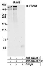 FRAS1 Antibody in Immunoprecipitation (IP)