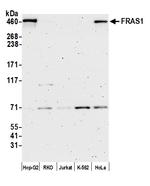 FRAS1 Polyclonal Antibody
