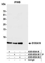 S100A16 Antibody in Immunoprecipitation (IP)