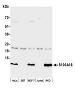S100A16 Polyclonal Antibody