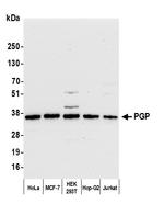 PGP Antibody in Western Blot (WB)