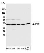 PGP Antibody in Western Blot (WB)