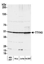 TTYH3 Polyclonal Antibody