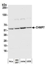 CHMP7 Polyclonal Antibody