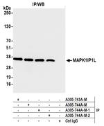 MAPK1IP1L Polyclonal Antibody